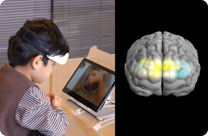 일반 동영상 시청 시 뇌 활성화