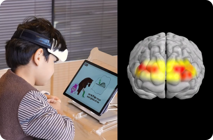 큐브 시청 시 뇌 활성화